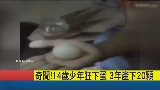 Anecdote: The world is anecdote! People will lay eggs? 14-year-old boy gave birth to 20 eggs, the re