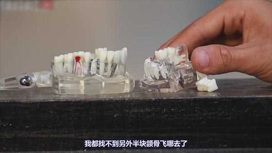 The hardest candy "dead" human teeth, the result is daunting, netizen: This sugar can kill me!