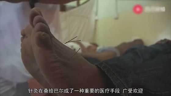 A black guy who was paralyzed for two weeks, Western medicine is helpless, African Chinese medicine: I am cured soon.
