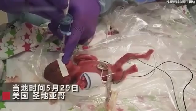 The world's smallest surviving baby has been discharged from hospital, and mothers have been told to live no more than an hour.
