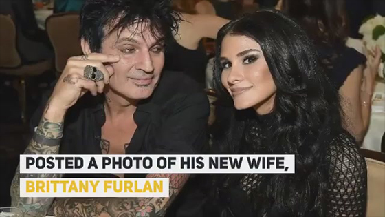 Tommy Lee shares photo of wife Brittany Furlan’s ‘100% natural body’
