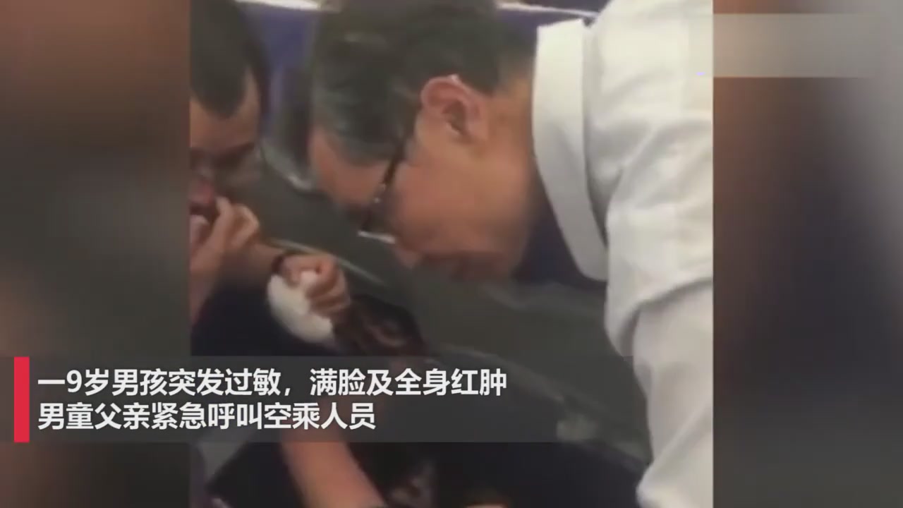 Academician Zhong Nanshan asked about the boy's sudden allergy on the plane