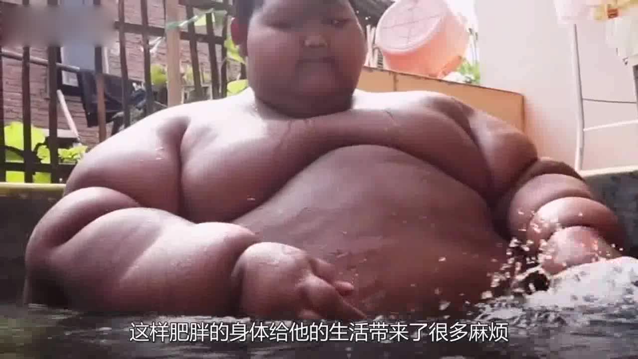 The boy who lost weight most successfully lost 212 kilograms in three years. After losing weight, it was more distressing.