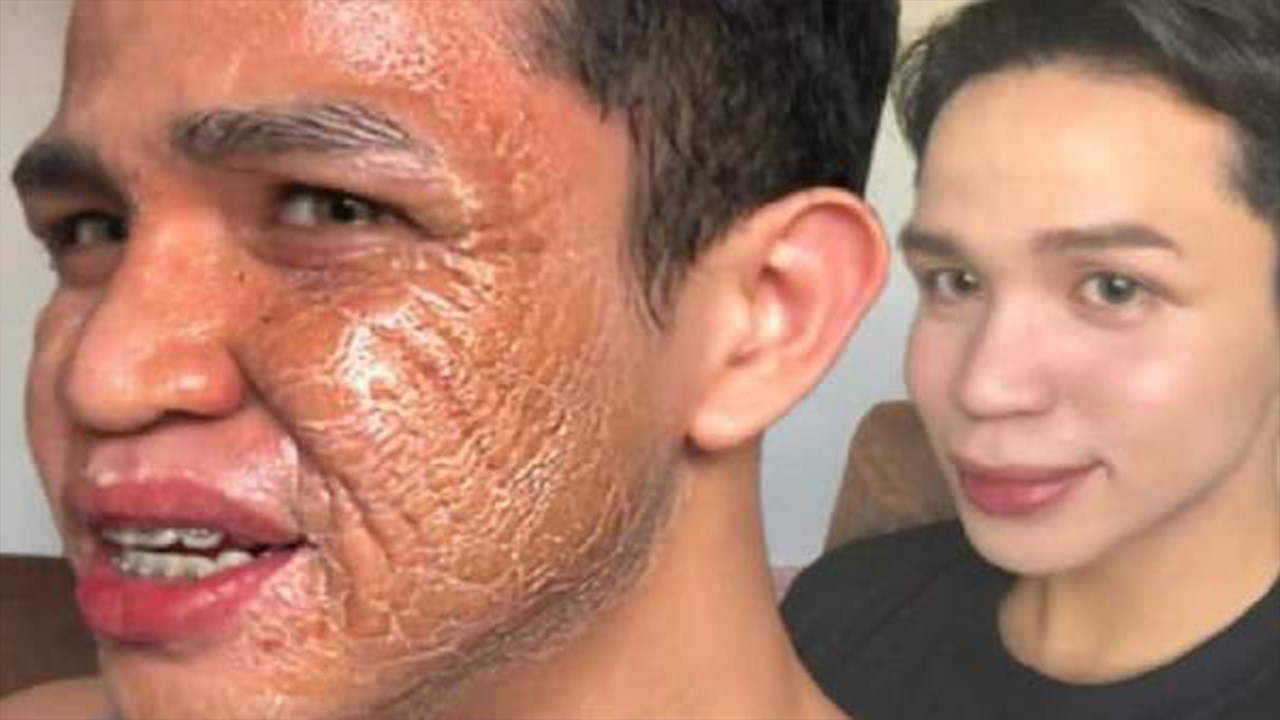 What happens to our skin after one year?