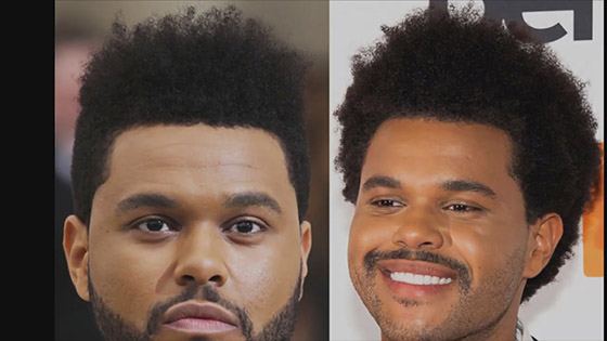 The Weeknd Showed Off His New Look - He Is Unrecognizable Now.