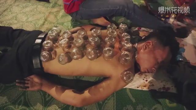 Massage room video:Vietnamese brother Street cupping