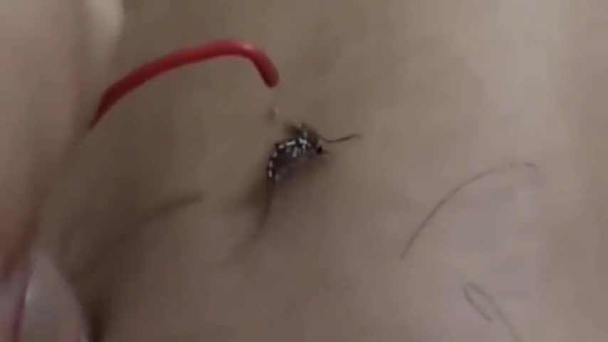 Mosquito: Just suck your blood. As for this electricity, don't you hurt yourself?