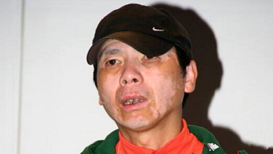 Feng Xiaogang's condition deteriorated! Hundreds of millions but no cure, his wife confessed to giving up treatment